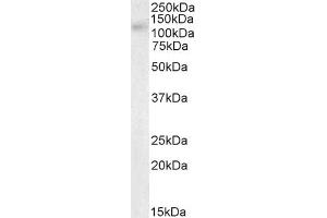 Western Blotting (WB) image for anti-ATP-Binding Cassette, Sub-Family C (CFTR/MRP), Member 11 (ABCC11) (Internal Region) antibody (ABIN302164)
