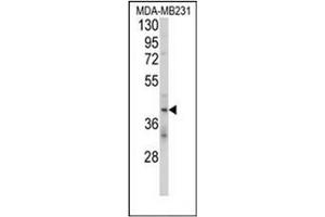 Western blot analysis of CD158d / KIR2DL4 Antibody (C-term) in MDA-MB231 cell line lysates (35ug/lane). (KIR2DL4/CD158d 抗体  (C-Term))