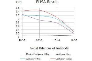 Black line: Control Antigen (100 ng),Purple line: Antigen (10 ng), Blue line: Antigen (50 ng), Red line:Antigen (100 ng) (PIK3R4 抗体  (AA 772-906))