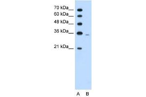 PRPS2 antibody used at 1. (PRPS2 抗体  (Middle Region))
