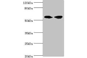 Western blot All lanes: AHCYL1 antibody at 12 μg/mL Lane 1: Hela whole cell lysate Lane 2: 293T whole cell lysate Secondary Goat polyclonal to rabbit IgG at 1/10000 dilution Predicted band size: 59, 54 kDa Observed band size: 59 kDa (AHCYL1 抗体  (AA 31-260))