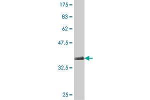 Western Blot detection against Immunogen (38. (TRIM9 抗体  (AA 1-109))
