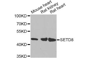 Western blot analysis of extracts of various cell lines, using SETD8 Antibody (ABIN5974407) at 1/1000 dilution. (SETD8 抗体)