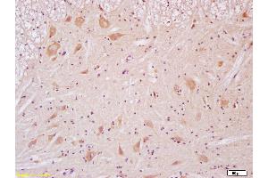 Immunohistochemistry (Paraffin-embedded Sections) (IHC (p)) image for anti-Glutamate Receptor, Ionotropic, N-Methyl D-Aspartate 2B (GRIN2B) (AA 451-550) antibody (ABIN726485)