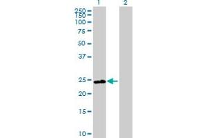 Western Blot analysis of DNAJB8 expression in transfected 293T cell line by DNAJB8 MaxPab polyclonal antibody. (DNAJB8 抗体  (AA 1-232))