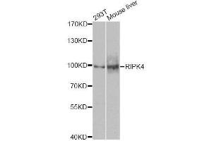 Western blot analysis of extracts of various cell lines, using RIPK4 antibody. (RIPK4 抗体  (AA 240-520))