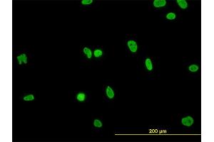 Immunofluorescence of monoclonal antibody to HNRNPG-T on HeLa cell. (RBMXL2 抗体  (AA 1-90))
