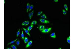 Immunofluorescent analysis of HepG2 cells using ABIN7171874 at dilution of 1:100 and Alexa Fluor 488-congugated AffiniPure Goat Anti-Rabbit IgG(H+L) (TSPAN33 抗体  (AA 118-235))