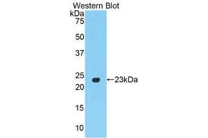 Western Blotting (WB) image for anti-Peroxisome Proliferator-Activated Receptor gamma (PPARG) (AA 311-493) antibody (ABIN3207603) (PPARG 抗体  (AA 311-493))
