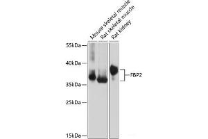 Western blot analysis of extracts of various cell lines using FBP2 Polyclonal Antibody at dilution of 1:1000. (FBP2 抗体)