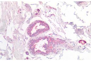 Detection of CSN2 in Human Breast Tissue using Polyclonal Antibody to Casein Beta (CSN2) (CSN2 抗体  (AA 41-198))