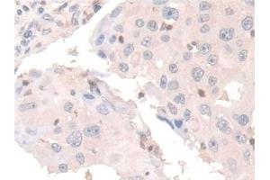 Immunohistochemistry (IHC) image for anti-Coactosin-Like Protein (AA 1-142) antibody (ABIN7436669)