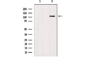 Western blot analysis of extracts from HepG2, using ZNF295 Antibody. (ZNF295 抗体  (N-Term))