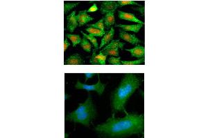 Immunofluorescence of human HeLa cells stained with PI (Red) and monoclonal anti-Maspin antibody (1:500) with Alexa 488 (Green). (SERPINB5 抗体)