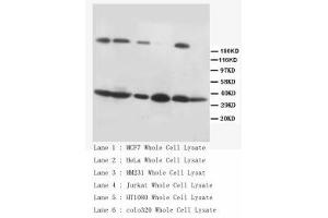 Image no. 2 for anti-Fas Ligand (TNF Superfamily, Member 6) (FASL) (C-Term) antibody (ABIN1492926) (FASL 抗体  (C-Term))