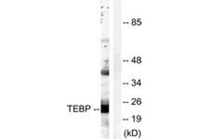 Western blot analysis of extracts from NIH-3T3 cells, treated with EGF 200ng/ml 30', using TEBP (Ab-113) Antibody. (NKX2-1 抗体  (AA 79-128))