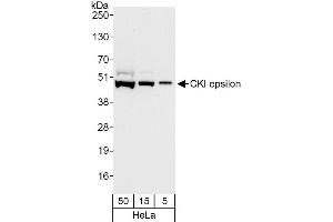Western Blotting (WB) image for anti-Casein Kinase 1, epsilon (CSNK1E) (AA 366-416) antibody (ABIN7451709)