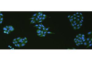 Immunofluorescence analysIs of HepG2 cell using SLC18A3 Polyclonal Antibody at dilution of 1:50 (SLC18A3 抗体)
