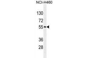Western Blotting (WB) image for anti-Mesoderm Induction Early Response 1, Family Member 2 (MIER2) antibody (ABIN2996066) (MIER2 抗体)