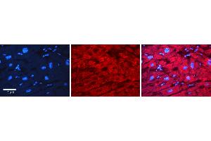 Rabbit Anti-SMC1A Antibody   Formalin Fixed Paraffin Embedded Tissue: Human heart Tissue Observed Staining: Cytoplasmic Primary Antibody Concentration: 1:100 Other Working Concentrations: N/A Secondary Antibody: Donkey anti-Rabbit-Cy3 Secondary Antibody Concentration: 1:200 Magnification: 20X Exposure Time: 0.