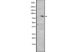 Western blot analysis of CCNT2 expression in HepG2 whole cell lysate ,The lane on the left is treated with the antigen-specific peptide. (Cyclin T2 抗体  (Internal Region))