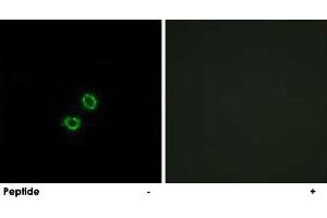 Immunofluorescence analysis of A-549 cells, using KIR2DL5B polyclonal antibody . (KIR2DL5B 抗体)