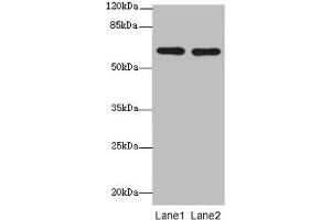 Western blot All lanes: CNOT2 antibody at 2 μg/mL Lane 1: 293T whole cell lysate Lane 2: Jurkat whole cell lysate Secondary Goat polyclonal to rabbit IgG at 1/10000 dilution Predicted band size: 60, 41, 23, 52, 55 kDa Observed band size: 60 kDa (CNOT2 抗体  (AA 1-335))