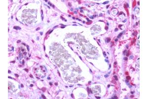 Human, Placenta: Formalin-Fixed Paraffin-Embedded (FFPE) (S1PR1 抗体  (Cytoplasmic Domain))