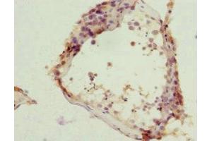 Immunohistochemistry of paraffin-embedded human testis tissue using ABIN7161952 at dilution of 1:100 (ZC3HC1 抗体  (AA 1-260))