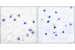 Immunohistochemistry analysis of paraffin-embedded human brain, using Tyrosine Hydroxylase (Phospho-Ser19) Antibody. (Tyrosine Hydroxylase 抗体  (pSer18))