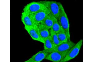 HepG2 cells were fixed in paraformaldehyde, permeabilized with 0. (Cytokeratin 18 抗体)