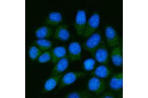 IF analysis of TSTA3/GFUS using anti-TSTA3/GFUS antibody (ABIN7825400). (GFUS (AA 44-321) 抗体)