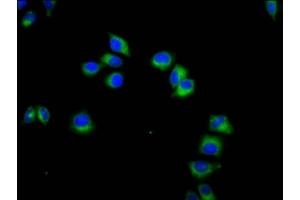 Immunofluorescence staining of Hela cells with ABIN7161649 at 1:133, counter-stained with DAPI. (KLRC3 抗体  (AA 94-240))