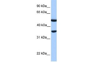 WB Suggested Anti-DNAJB6 Antibody Titration: 0. (DNAJB6 抗体  (N-Term))