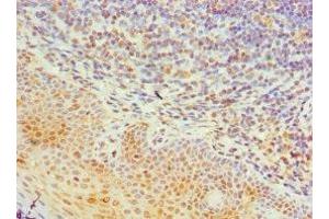 Immunohistochemistry of paraffin-embedded human tonsil tissue using ABIN7161993 at dilution of 1: 100 (TIA1 抗体  (AA 1-193))