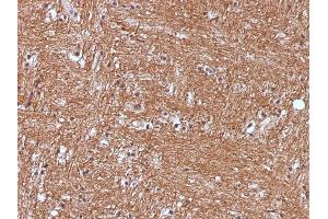 Formalin-fixed, paraffin-embedded human Cerebellum stained with NSE gamma Monoclonal Antibody (ENO2/1375). (ENO2/NSE 抗体  (AA 416-433))