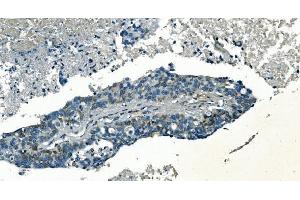 IHC analysis of PI-16/PI16 using anti-PI-16/PI16 antibody (ABIN7601074).