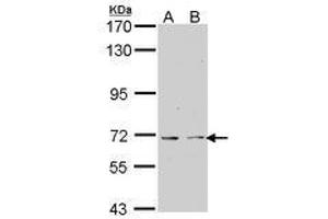 Image no. 1 for anti-K(lysine) Acetyltransferase 5 (KAT5) (AA 230-462) antibody (ABIN467563) (KAT5 抗体  (AA 230-462))