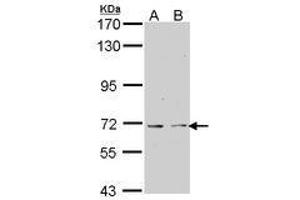 Image no. 1 for anti-K(lysine) Acetyltransferase 5 (KAT5) (AA 230-462) antibody (ABIN467563) (KAT5 抗体  (AA 230-462))