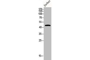 Western Blot analysis of JK cells using Phospho-MKP-1/2 (S296/318) Polyclonal Antibody (MKP-1/2 抗体  (pSer296, pSer318))