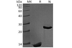Western Blotting (WB) image for Transforming Growth Factor, beta 1 (TGFB1) (Active) protein (ABIN7320668) (TGFB1 蛋白)