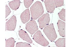 Human, Skeletal muscle: Formalin-Fixed Paraffin-Embedded (FFPE).