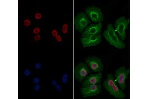 ABIN6258036 and ABIN6274198 staining Hela by IF/ICC. (CSRP1 抗体  (Internal Region))