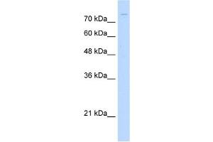 ZNF709 antibody (20R-1237) used at 0. (ZNF709 抗体  (N-Term))
