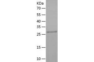 Western Blotting (WB) image for Sirtuin 3 (SIRT3) (AA 118-399) protein (His tag) (ABIN7289055) (SIRT3 Protein (AA 118-399) (His tag))