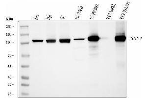 Western blot analysis of SND1 using anti-SND1 antibody (ABIN7600525). (SND1 抗体  (AA 20-204))