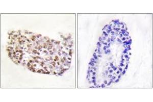 Immunohistochemistry analysis of paraffin-embedded human thyroid gland tissue, using NFAT5 (Ab-1197) Antibody. (NFAT5 抗体  (AA 1171-1220))