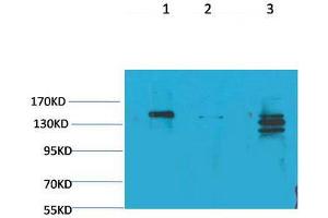 Western Blot (WB) analysis of 1) Rat Brain Tissue, 2)Mouse Brain Tissue, 3) HeLa with SLC12A4 Rabbit Polyclonal Antibody diluted at 1:2000. (SLC12A4 抗体)