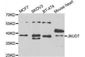 Western blot analysis of extracts of various cell lines, using JMJD7 antibody. (JMJD7 抗体)