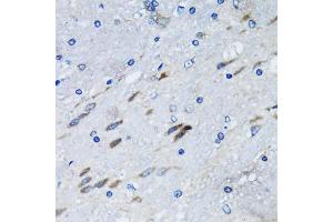 Immunohistochemistry of paraffin-embedded mouse brain using BLZF1 antibody (ABIN2561429) at dilution of 1:100 (40x lens). (BLZF1 抗体)